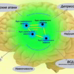 Модель невроза с позиции ядер ущемленных аффектов